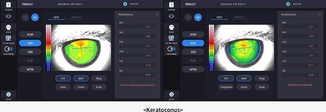 2bc597e60a1d0b64655222a171ea6792_1698317320_5184.jpg 2bc597e60a1d0b64655222a171ea6792_1698317320_5184.jpg