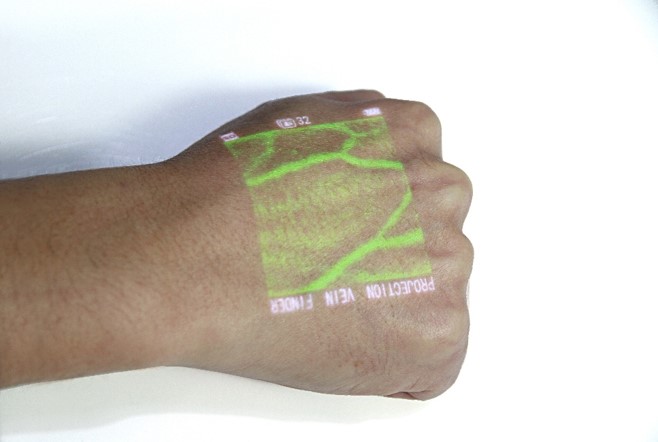 veincas_green_light_veinfinder veincas_green_light_veinfinder